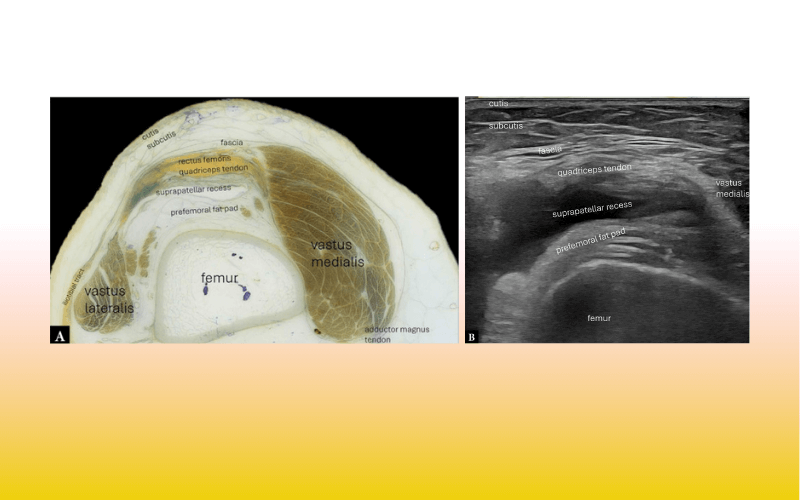 2. Compartimento anterior rodilla tempo formacion.png